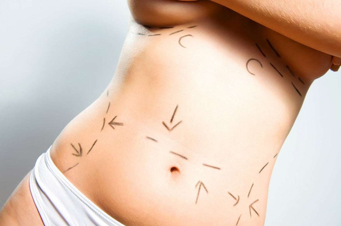 Cirurgia Plástica e Fisioterapia
