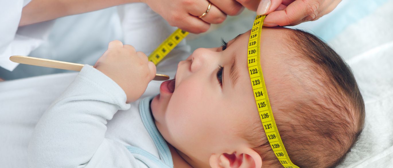 O que é cranioestenose e como ela afeta o bebê?